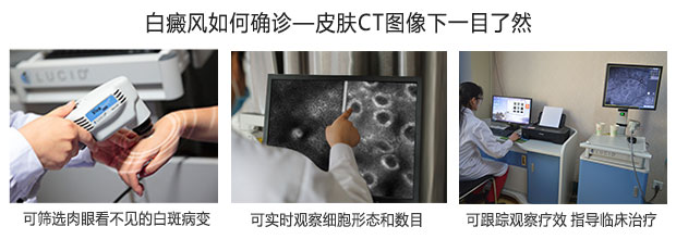美国三维皮肤CT